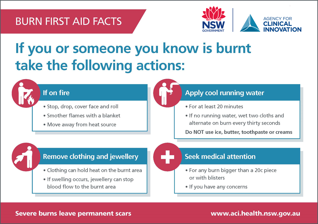 burn first aid