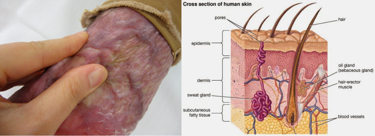 sebaceous oil glands